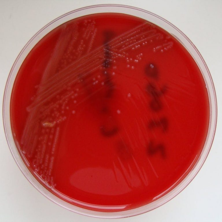 What led to world’s worst listeriosis outbreak in South Africa