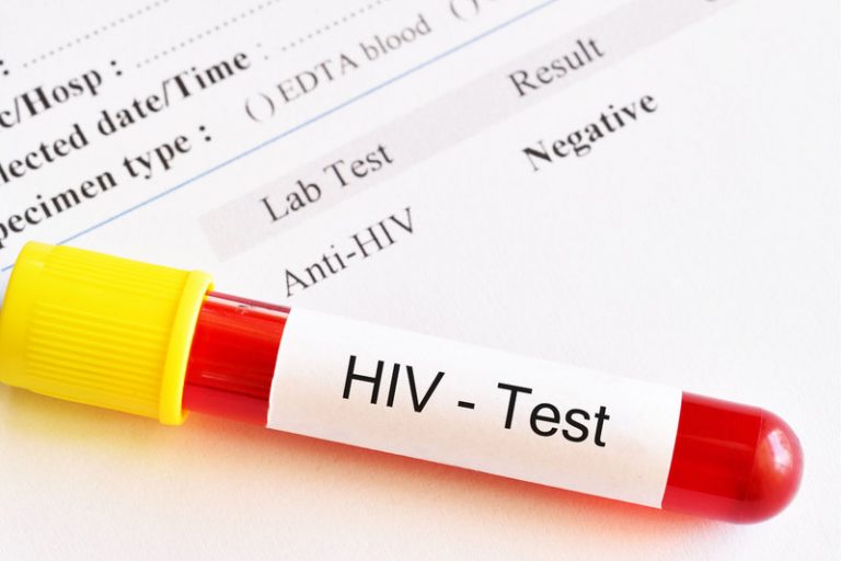 What the discovery of a new HIV strain means for the pandemic
